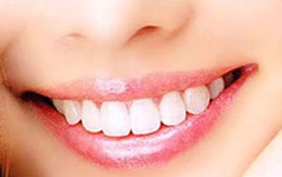 Mẹo ‘tẩy’ sạch cao răng chỉ trong 5 phút