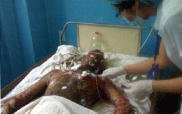 Tấn bi kịch của những kẻ yêu cuồng