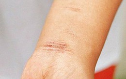 Một nam thanh niên cắt tay tự tử được cảnh sát cứu