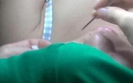 Oái oăm kiểu làm đẹp mất tiền, biến dạng
