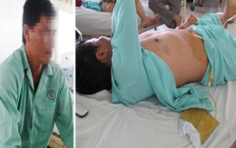 Rộ lên các vụ "hoạn"... chồng