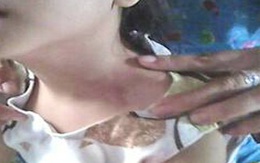 Đau lòng trẻ bị thiểu năng bị nhân viên nhà nghỉ hiếp dâm 2 ngày liên tiếp