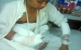 Cưa gái làng, nam thanh niên bị chém lìa tay