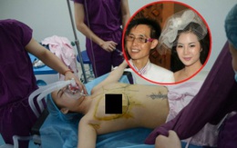 Sốc với ảnh cận cảnh phẫu thuật ngực của vợ cũ đạo diễn Đặng Kiến Quốc