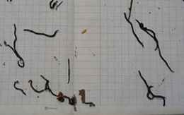 Hoảng hồn vì hàng nghìn sinh vật lạ bò vào nhà