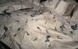 "Sinh vật lạ" trong quần áo là ấu trùng ruồi giả ong