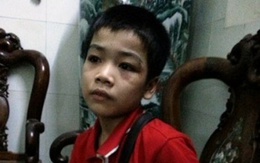 TP HCM: Bắt khẩn cấp kẻ hành hạ dã man 4 đứa trẻ