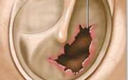 Cảnh cáo một đại tá đánh trẻ thủng màng nhĩ