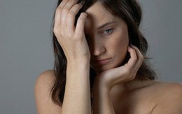 Hỏi và đáp về bệnh vẩy nến