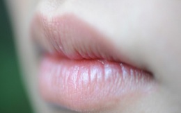 Mẹo xóa vết thâm ở môi