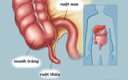 Nhận biết các triệu chứng của viêm ruột thừa