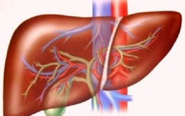 Những triệu chứng của bệnh gan dễ nhận biết nhất