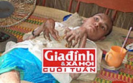 Bí ẩn chứng bệnh của người đàn ông “hóa rắn” sau khi ăn rắn độc 