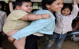 Bé trai khổng lồ, 2 tuổi nặng hơn 30kg