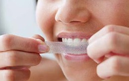 5 mẹo làm trắng răng tức khắc 