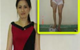 Chuyện cô giáo phẫu thuật kéo dài 12cm chân