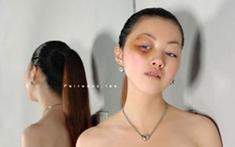 Cưới 4 tháng đã bị chồng đánh nhiều không nhớ nổi