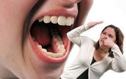 Những mẹo nhỏ chống hôi miệng