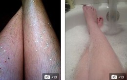 Những cô gái trẻ đua nhau khoe ảnh lông chân rậm rạp