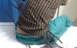 Thiếu nữ bị 3 thanh thép đâm xuyên người vẫn sống