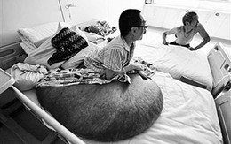 Liệt giường vì khối u khổng lồ, nặng 100kg trên người