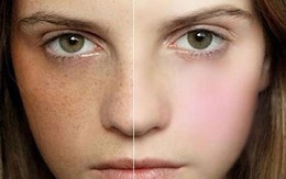 Kỹ năng trang điểm xóa bay tàn nhang