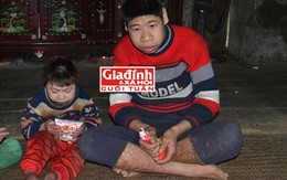 Chuyện đau lòng trong gia đình những đứa trẻ sinh ra đều mang hình hài của… khỉ