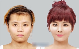 Cô gái "nam tính" phải phẫu thuật để giống phụ nữ