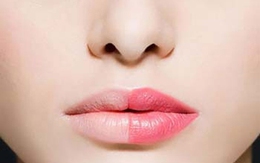 Tạm biệt môi thâm với liệu pháp từ thiên nhiên