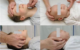 Cách xử trí khi bé bị hóc dị vật
