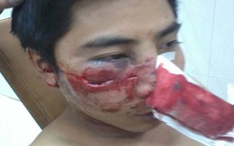 Chưa khẳng định được việc 141 đánh người