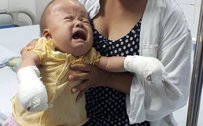 Tiếng khóc xé lòng của bé 17 tháng tuổi bị dị dạng