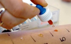 Làm cách nào để phân biệt giữa cảm lạnh và viêm mũi dị ứng?