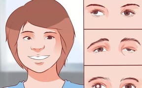 Cách nhận biết bệnh nhược thị tuổi học đường