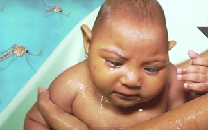 Sắp thử nghiệm thuốc điều trị Zika trên người