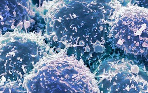 Chế tạo thành công loại virus chuyên diệt tế bào ung thư