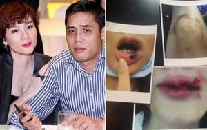 Dương Yến Ngọc - Á hậu, cựu người mẫu từng khổ sở vì bị bạo hành, yêu nhiều nhưng mãi chưa tìm được hạnh phúc