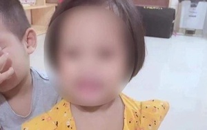 Thực hư thông tin bé 3 tuổi bị đóng đinh vào đầu được phẫu thuật thành công