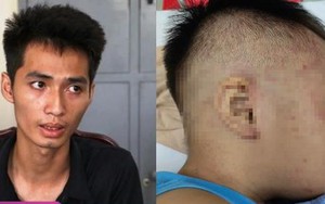 Bé trai 3 tuổi bị đánh đập, nhét tủ đông sẽ nguy hiểm tính mạng thế nào nếu không được phát hiện kịp thời?