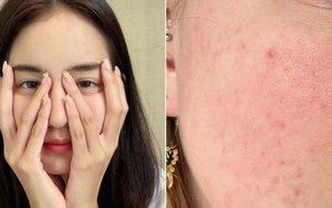 Tác nhân gây lão hóa da không thua gì tia tử ngoại mà chị em hay bỏ qua
