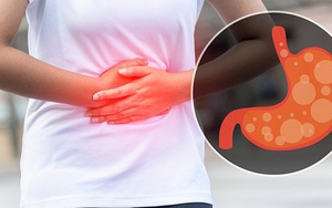 10 biện pháp giảm đầy hơi nhanh chóng