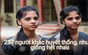 Ngôi làng lạ lùng: 237 người khác huyết thống nhưng giống hệt nhau, cách phân biệt không ai ngờ tới, khoa học chưa thể giải thích