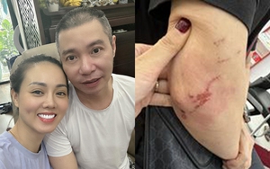 Chồng bị ngã chưa hồi phục, vợ trẻ NSND Công Lý làm gì để lo cho gia đình?