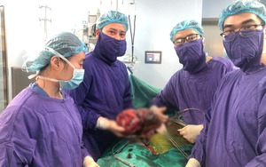 Phẫu thuật khối u thận đa nang nặng 2,8kg cho nữ bệnh nhân suy thận giai đoạn cuối