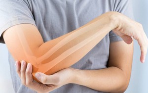 Những thực phẩm rẻ tiền, dễ kiếm nhưng giàu canxi, không muốn mắc bệnh xương khớp hãy bổ sung vào thực đơn