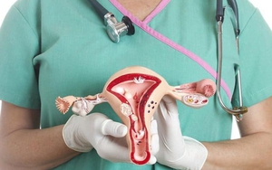 Cổ tử cung và cách phòng tránh ung thư cổ tử cung