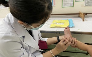 Xác định được kiểu gene của Enterovirus 71 gây bệnh tay chân miệng nặng