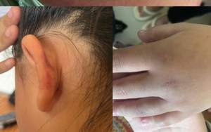 Xác minh thông tin nữ sinh Phú Yên bị lột đồ, đánh hội đồng suốt 2 giờ đồng hồ