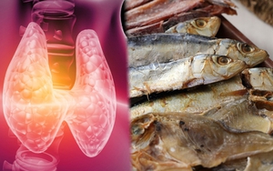 Những thực phẩm mà bệnh nhân suy giáp không nên tiêu thụ nhiều