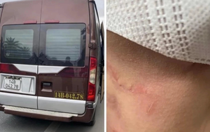 Tin sáng 29/2: Công an vào cuộc vụ hành khách tố bị hành hung khi đòi xuống xe; xôn xao vợ chồng ca sĩ nổi tiếng showbiz Việt cãi nhau với chủ quán ăn